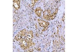 IHC analysis of SSRP1 using anti-SSRP1 antibody (ABIN7600496). (SSRP1 antibody  (AA 2-381))