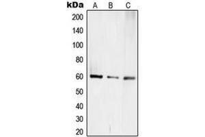 Western blot analysis of TCEB3C expression in Jurkat (A), mouse kidney (B), rat kidney (C) whole cell lysates. (TCEB3C antibody  (C-Term))