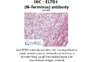 Image no. 1 for anti-EGF, Latrophilin and Seven Transmembrane Domain Containing 1 (ELTD1) (Extracellular Domain), (N-Term) antibody (ABIN1733980) (ELTD1 antibody  (Extracellular Domain, N-Term))