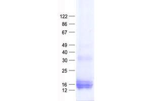 Validation with Western Blot (Atp Synthase Subunit S protein (His tag))