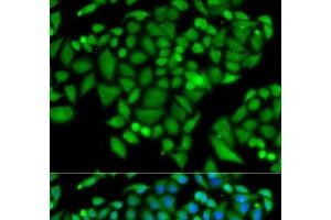 Immunofluorescence analysis of MCF-7 cells using CHAF1B Polyclonal Antibody (CHAF1B antibody)
