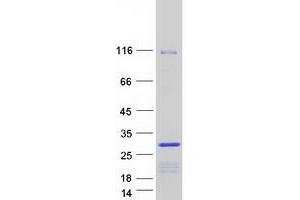 Validation with Western Blot