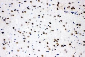 IHC analysis of SF2/SRSF1 using anti-SF2/SRSF1 antibody (ABIN3043296).