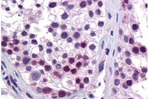 Human Testis: Formalin-Fixed, Paraffin-Embedded (FFPE) (HOXA5 antibody  (AA 143-192))