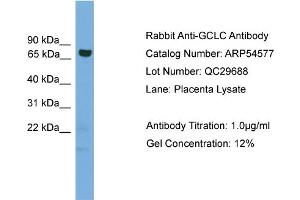 WB Suggested Anti-GCLC  Antibody Titration: 0. (GCLC antibody  (Middle Region))