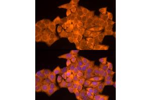 anti-N-Acetyltransferase 1 (Arylamine N-Acetyltransferase) (NAT1) antibody