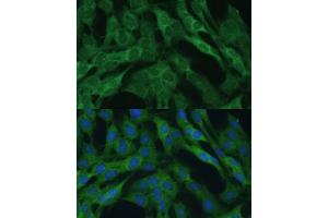 Immunofluorescence analysis of C6 cells using IDH1 Polyclonal Antibody (ABIN6131797, ABIN6142143, ABIN6142144 and ABIN6217174) at dilution of 1:100 (40x lens). (IDH1 antibody  (AA 1-414))