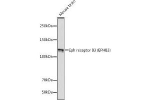 Western blot analysis of extracts of Mouse brain, using Eph receptor B3 (EPHB3) (EPHB3) antibody (ABIN7266972) at 1:1000 dilution. (EPH Receptor B3 antibody)