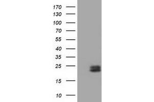 Western Blotting (WB) image for anti-Ephrin A2 (EFNA2) antibody (ABIN1497957) (Ephrin A2 antibody)