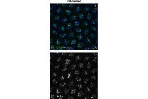 Immunofluorescence (Paraffin-embedded Sections) (IF (p)) image for anti-Histone H2A Variant (HIS2AV) (Internal Region), (pSer137) antibody (ABIN129671)