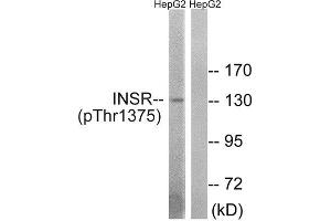 Western Blotting (WB) image for anti-IR (C-Term), (pThr1365), (pThr1375), (pThr1376) antibody (ABIN1847602) (IR (C-Term), (pThr1365), (pThr1375), (pThr1376) antibody)