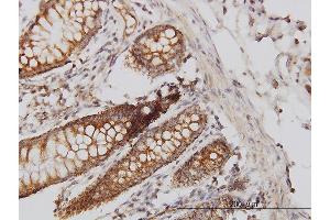 Immunoperoxidase of monoclonal antibody to HIP1 on formalin-fixed paraffin-embedded human colon. (HIP1 antibody  (AA 928-1037))