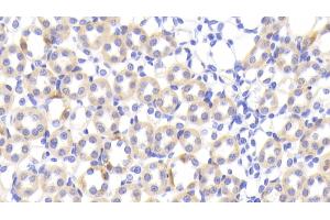 Detection of FABP1 in Rat Kidney Tissue using Polyclonal Antibody to Fatty Acid Binding Protein 1 (FABP1) (FABP1 antibody  (AA 1-127))