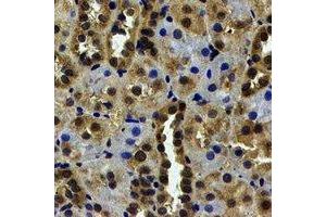 Immunohistochemical analysis of USP7 staining in human kidney formalin fixed paraffin embedded tissue section.
