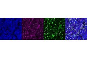 Immunohistochemistry (IHC) image for anti-Coiled-Coil Domain Containing 153 (CCDC153) antibody (ABIN7456187)