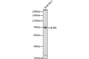 Western blot analysis of extracts of R. (IL2 Receptor beta antibody  (AA 27-240))