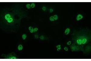 Anti-TP53 mouse monoclonal antibody (ABIN2454550) immunofluorescent staining of COS7 cells transiently transfected by pCMV6-ENTRY TP53 (RC200003). (p53 antibody)