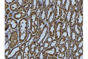 ABIN6279484 at 1/100 staining Rat kidney tissue by IHC-P. (HLA-DMA antibody)