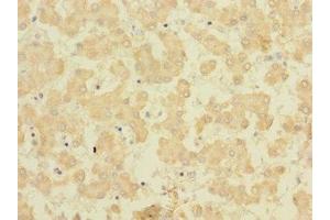 Immunohistochemistry of paraffin-embedded human liver tissue using ABIN7165454 at dilution of 1:100 (FAM187B antibody  (AA 18-335))