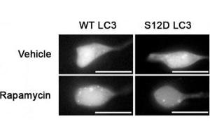 SH-SY5Y cells expressing GFP-LC3-WT or-S12D mutation (reduced puncta) treated with rapamycin or vehicle for 1h and probed with phospho-LC3C antibody (LC3C antibody  (pSer12))