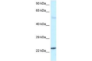 WB Suggested Anti-RAB31 Antibody Titration: 1. (RAB31 antibody  (C-Term))