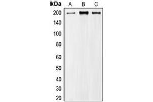 Western blot analysis of MRCK alpha expression in A549 (A), HeLa (B), NIH3T3 (C) whole cell lysates.