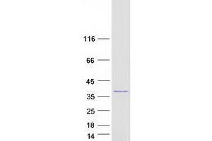 Validation with Western Blot (TST Protein (Myc-DYKDDDDK Tag))