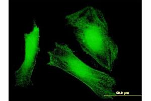 Immunofluorescence of purified MaxPab antibody to DCUN1D3 on HeLa cell. (DCUN1D3 antibody  (AA 1-304))