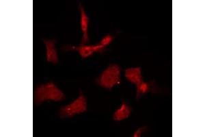 ABIN6267009 staining K562 by IF/ICC. (AKT1/3 antibody)