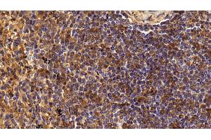 Detection of CD4 in Human Spleen Tissue using Polyclonal Antibody to Cluster Of Differentiation 4 (CD4) (CD4 antibody  (AA 27-394))