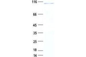 Validation with Western Blot (UTP14A Protein (DYKDDDDK Tag))
