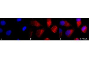 Immunocytochemistry/Immunofluorescence analysis using Rabbit Anti-TNF-R1 Polyclonal Antibody . (TNFRSF1A antibody  (AA 20-43) (Atto 488))