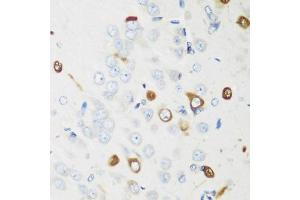 Immunohistochemistry of paraffin-embedded rat brain using EL antibody (ABIN6134649, ABIN6140114, ABIN6140116 and ABIN6221621) at dilution of 1:200 (40x lens). (ELAVL2 antibody  (AA 1-100))