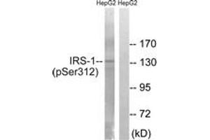 Western blot analysis of extracts from HepG2 cells, using IRS-1 (Phospho-Ser312) Antibody. (IRS1 antibody  (pSer312))
