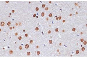 Immunohistochemistry of paraffin-embedded Rat brain using PELP1 Polyclonal Antibody at dilution of 1:100 (40x lens). (PELP1 antibody)