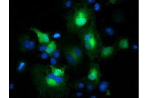 Anti-MAPRE2 mouse monoclonal antibody (ABIN2454584) immunofluorescent staining of COS7 cells transiently transfected by pCMV6-ENTRY MAPRE2 (RC200259). (MAPRE2 antibody)
