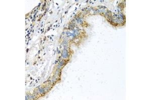 Immunohistochemistry of paraffin-embedded human trachea using ATPIF1 antibody. (ATPase Inhibitory Factor 1 antibody  (AA 26-106))