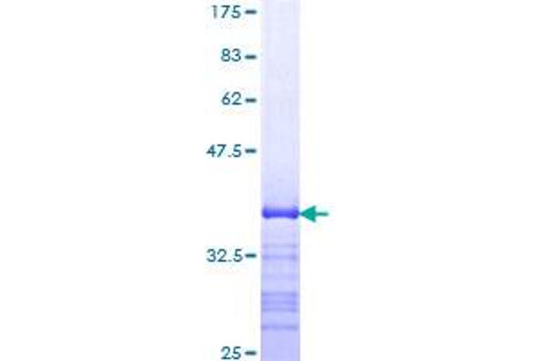 SMAD7 Protein (AA 160-260) (GST tag)