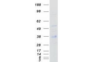 Validation with Western Blot (CD79b Protein (Transcript Variant 3) (Myc-DYKDDDDK Tag))
