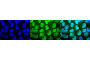 Immunocytochemistry/Immunofluorescence analysis using Rabbit Anti-Methylated Lysine Polyclonal Antibody (ABIN5650777). (Lysine (lys) (methylated) antibody (APC))