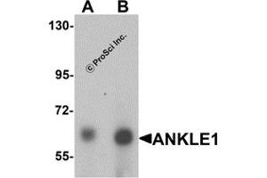 Western Blotting (WB) image for anti-Ankyrin Repeat and LEM Domain Containing 1 (ANKLE1) (C-Term) antibody (ABIN1030236) (ANKLE1 antibody  (C-Term))