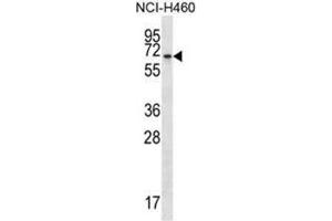 BEND4 Antibody (N-term) western blot analysis in NCI-H460 cell line lysates (35µg/lane). (BEND4 antibody  (N-Term))