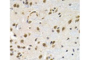 Immunohistochemistry of paraffin-embedded Rat brain using LBR Polyclonal Antibody at dilution of 1:200 (40x lens). (Lamin B Receptor antibody)