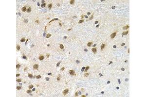 Immunohistochemistry of paraffin-embedded Rat brain using LBR Polyclonal Antibody at dilution of 1:200 (40x lens).
