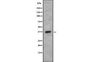 Western blot analysis OR5T1 using 293 whole cell lysates (OR5T1 antibody)
