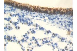 #VALUE! (Androgen Receptor antibody  (AA 156-310))