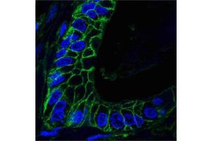 Immunocytochemistry (ICC) image for anti-CD44 (CD44) antibody (ABIN969026)
