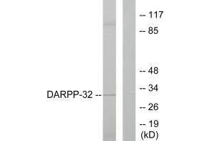 Western blot analysis of extracts from 293 cells treated with EGF (200 ng/mL, 30 min), using DARPP-32 (Ab-75) antibody. (DARPP32 antibody  (Thr75))