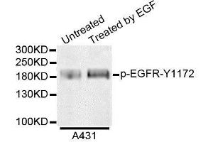 Western blot analysis of extracts from A431 cells, using Phospho-EGFR-Y1172 antibody. (EGFR antibody  (pTyr1148))