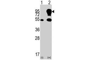 Western blot analysis of BRAF (arrow) using BRAF polyclonal antibody .